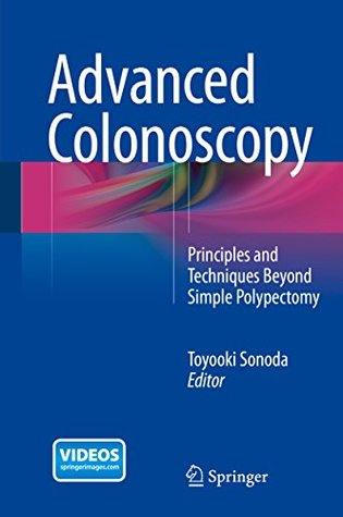 [befca] *R.e.a.d~ Advanced Colonoscopy: Principles and Techniques Beyond Simple Polypectomy - Toyooki Sonoda #e.P.u.b@